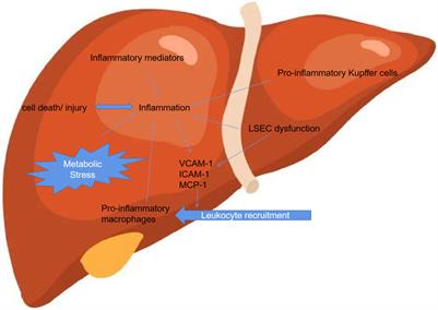 Recent evaluation about inflammatory mechanisms in nonalcoholic fatty liver disease